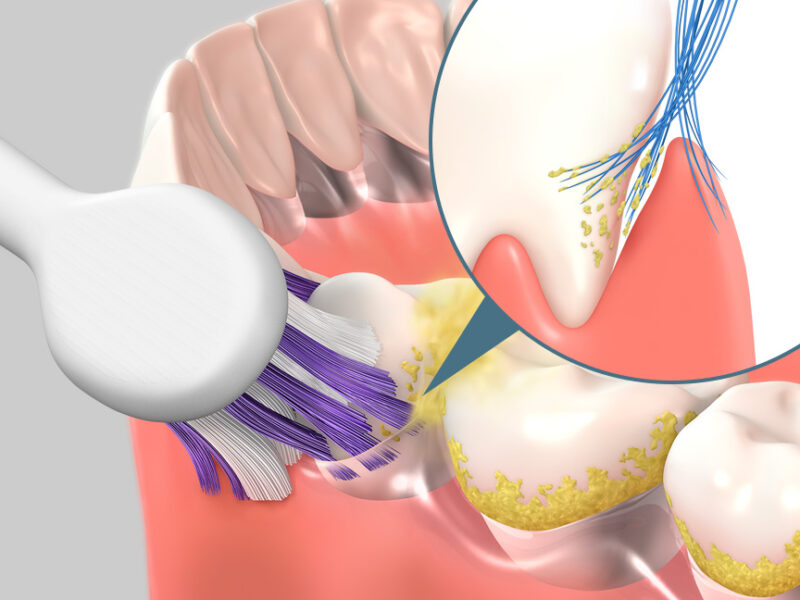 ブリリアンス毛